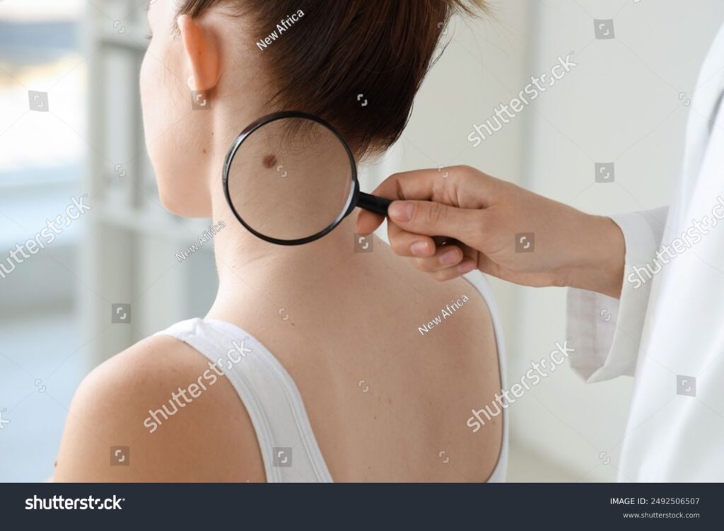 Lorem ipsum dolor sit amet consectetur adipiscing 2 Greenville Skin Dermatology and Cosmetics stock photo doctor examining woman s mole with magnifying glass in clinic closeup 2492506507 Greenville Skin Trusted Dermatologist in Greenville, SC | Medical & Cosmetic Skin Care